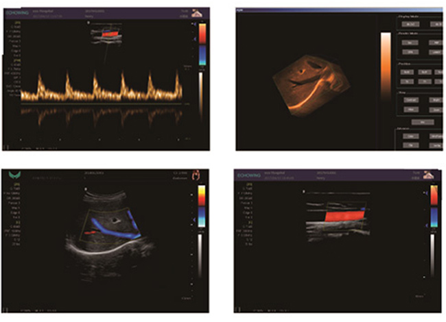Color Doppler Ultrasound System Imaging