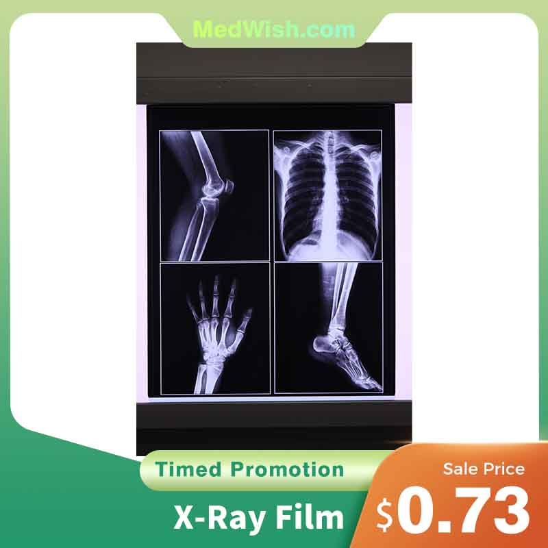 Medical X-Ray Film