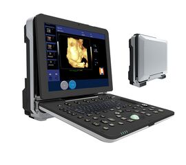 Portable 4D Ultrasound Machine