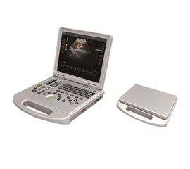 Economical Type Laptop Color Doppler Ultrasound Scanner