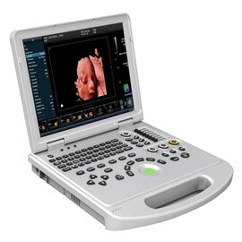 Color Doppler Portable Ultrasound Scanner