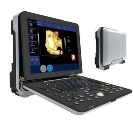 Portable 4D Ultrasound Machine