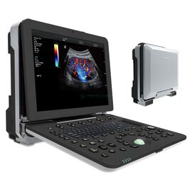 4D Portable Cardiovascular Ultrasound Machine