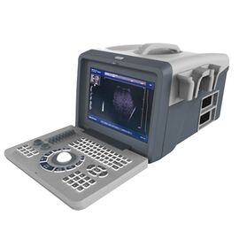Portable Diagnostic Ultrasound Machine