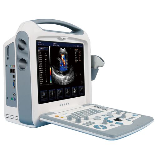 Medical Color Doppler Diagnostic Ultrasound Machine