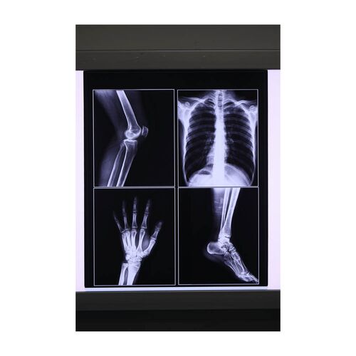 Medical Digital X-ray Film