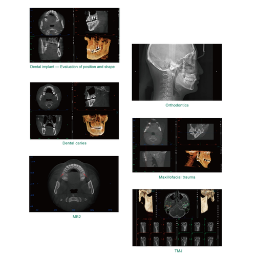 Dental CT Image