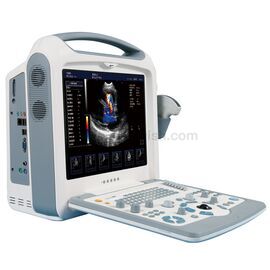 Medical Color Doppler Diagnostic Ultrasound Machine